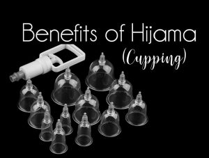 hijama-cupping